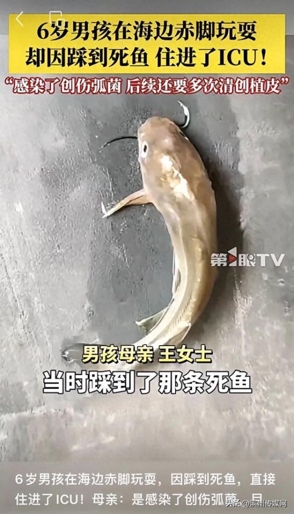 鼎冠配资 6岁男童沙滩光脚踩到死鱼，第二天高烧晕倒紧急送进ICU！最新消息传来，“脚保住了不用截肢……”